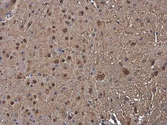 Anti-PSMB1 antibody used in IHC (Paraffin sections) (IHC-P). GTX130875