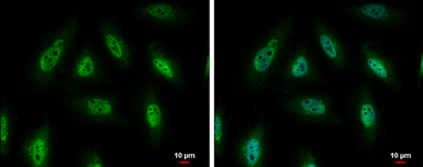 Anti-PYK2 antibody used in Immunocytochemistry/ Immunofluorescence (ICC/IF). GTX130887