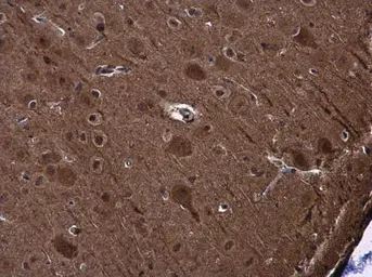 Anti-PYK2 antibody used in IHC (Paraffin sections) (IHC-P). GTX130887