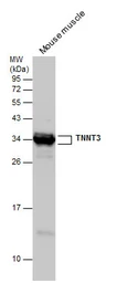 Anti-Troponin T fast skeletal antibody used in Western Blot (WB). GTX130922