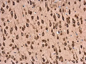 Anti-RPL22 antibody used in IHC (Paraffin sections) (IHC-P). GTX130972