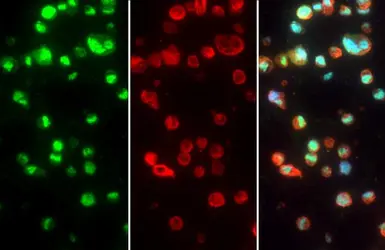 Anti-Tristetraprolin antibody used in IHC (Paraffin sections) (IHC-P). GTX130974