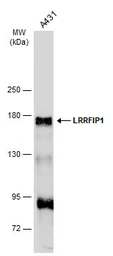 Anti-LRRFIP1 antibody used in Western Blot (WB). GTX131026