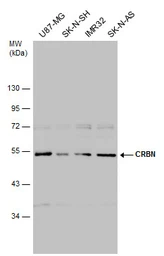 Anti-CRBN antibody used in Western Blot (WB). GTX131077