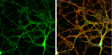 Anti-Neuroligin 3 antibody used in Immunocytochemistry/ Immunofluorescence (ICC/IF). GTX131085