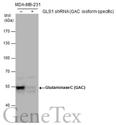 Anti-Glutaminase C (GAC) antibody used in Western Blot (WB). GTX131263