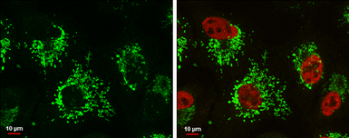 Anti-Glutaminase C (GAC) antibody used in Immunocytochemistry/ Immunofluorescence (ICC/IF). GTX131263
