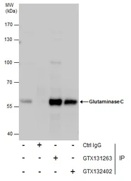 Anti-Glutaminase C (GAC) antibody used in Immunoprecipitation (IP). GTX131263