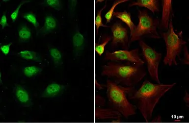 Anti-Brachyury antibody used in Immunocytochemistry/ Immunofluorescence (ICC/IF). GTX131339