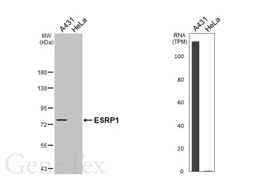 Anti-ESRP1 antibody used in Western Blot (WB). GTX131373