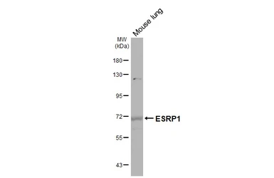 Anti-ESRP1 antibody used in Western Blot (WB). GTX131373