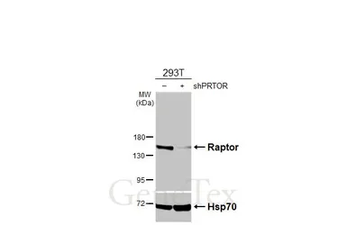 Anti-Raptor antibody used in Western Blot (WB). GTX131508