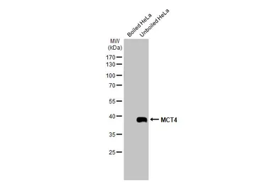 Anti-MCT4 antibody used in Western Blot (WB). GTX131626