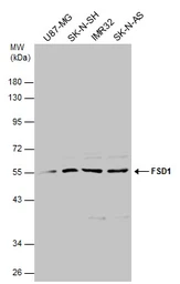 Anti-FSD1 antibody used in Western Blot (WB). GTX131769