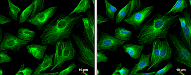 Anti-FSD1 antibody used in Immunocytochemistry/ Immunofluorescence (ICC/IF). GTX131769