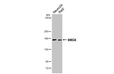 Anti-SMG6 antibody used in Western Blot (WB). GTX131919
