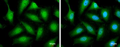 Anti-STAT5B antibody used in Immunocytochemistry/ Immunofluorescence (ICC/IF). GTX132113