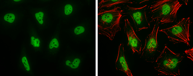 Anti-BRG1 antibody used in Immunocytochemistry/ Immunofluorescence (ICC/IF). GTX132121