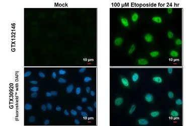 Anti-ATM (phospho Ser1981) antibody used in Immunocytochemistry/ Immunofluorescence (ICC/IF). GTX132146