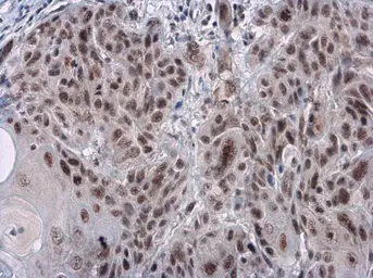 Anti-Rad17 (phospho Ser656) antibody used in IHC (Paraffin sections) (IHC-P). GTX132150