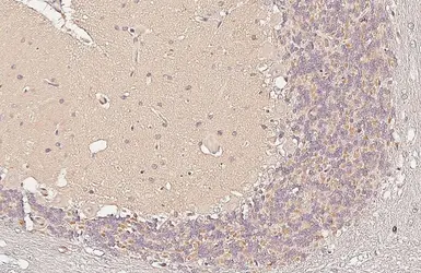 Anti-Adenosine A2b Receptor antibody used in IHC (Paraffin sections) (IHC-P). GTX132217
