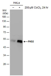 Anti-PHD2 antibody used in Western Blot (WB). GTX132293