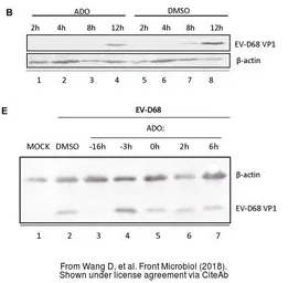 Anti-Enterovirus D68 VP1 antibody used in Western Blot (WB). GTX132312