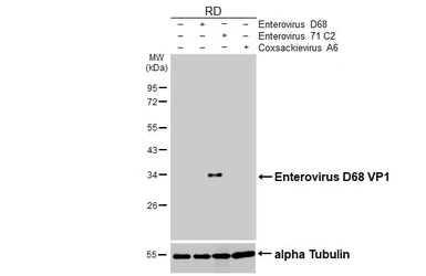 Anti-Enterovirus D68 VP1 antibody used in Western Blot (WB). GTX132312