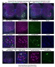 Anti-Enterovirus D68 VP2 antibody used in IHC (Frozen sections) (IHC-Fr). GTX132314