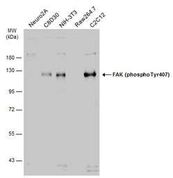 Anti-FAK (phospho Tyr407) antibody used in Western Blot (WB). GTX132320