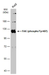 Anti-FAK (phospho Tyr407) antibody used in Western Blot (WB). GTX132320