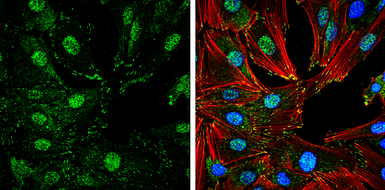 Anti-FAK (phospho Tyr407) antibody used in Immunocytochemistry/ Immunofluorescence (ICC/IF). GTX132320