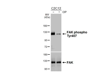 Anti-FAK (phospho Tyr407) antibody used in Western Blot (WB). GTX132320