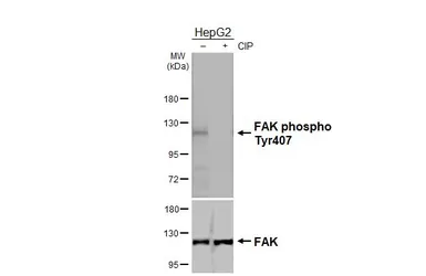 Anti-FAK (phospho Tyr407) antibody used in Western Blot (WB). GTX132320