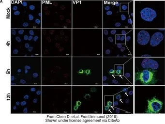 Anti-Enterovirus 71 VP1 antibody used in Immunocytochemistry/ Immunofluorescence (ICC/IF). GTX132338