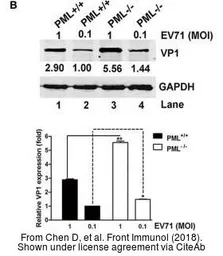 Anti-Enterovirus 71 VP1 antibody used in Western Blot (WB). GTX132338
