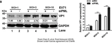 Anti-Enterovirus 71 VP1 antibody used in Western Blot (WB). GTX132338