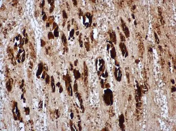Anti-Enterovirus 71 VP1 antibody used in IHC (Paraffin sections) (IHC-P). GTX132338