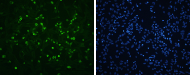 Anti-Enterovirus 71 VP1 antibody used in Immunocytochemistry/ Immunofluorescence (ICC/IF). GTX132338