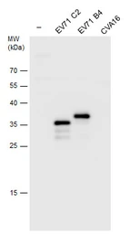 Anti-Enterovirus 71 VP1 antibody used in Western Blot (WB). GTX132339