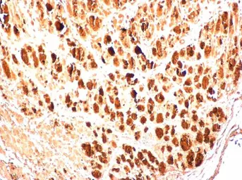 Anti-Enterovirus 71 3AB antibody used in IHC (Paraffin sections) (IHC-P). GTX132344