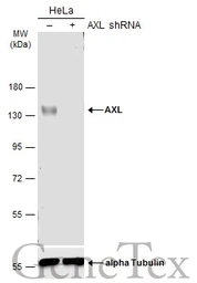 Anti-AXL antibody used in Western Blot (WB). GTX132386
