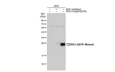 Anti-RAS (Q61R Mutant) antibody used in Western Blot (WB). GTX132406