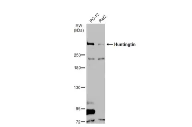 Anti-Huntingtin antibody used in Western Blot (WB). GTX132433