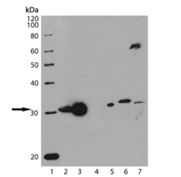 Anti-Heme Oxygenase 1 antibody [HO-1-1] used in Western Blot (WB). GTX13248