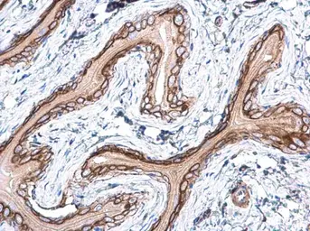 Anti-RAS antibody used in IHC (Paraffin sections) (IHC-P). GTX132480