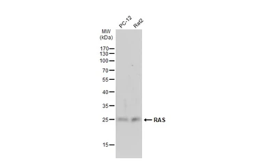 Anti-RAS antibody used in Western Blot (WB). GTX132480