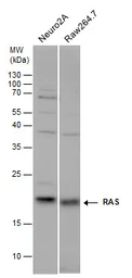 Anti-RAS antibody used in Western Blot (WB). GTX132480