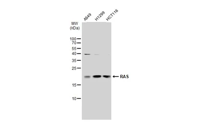 Anti-RAS antibody used in Western Blot (WB). GTX132480
