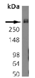 Anti-Bassoon antibody [SAP7F407] used in Western Blot (WB). GTX13249